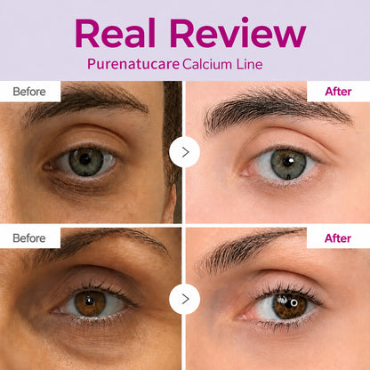 🔥LAST DAY 50% OFF!!Purenatucare Korean Calcium Dark Spot Eye Cream