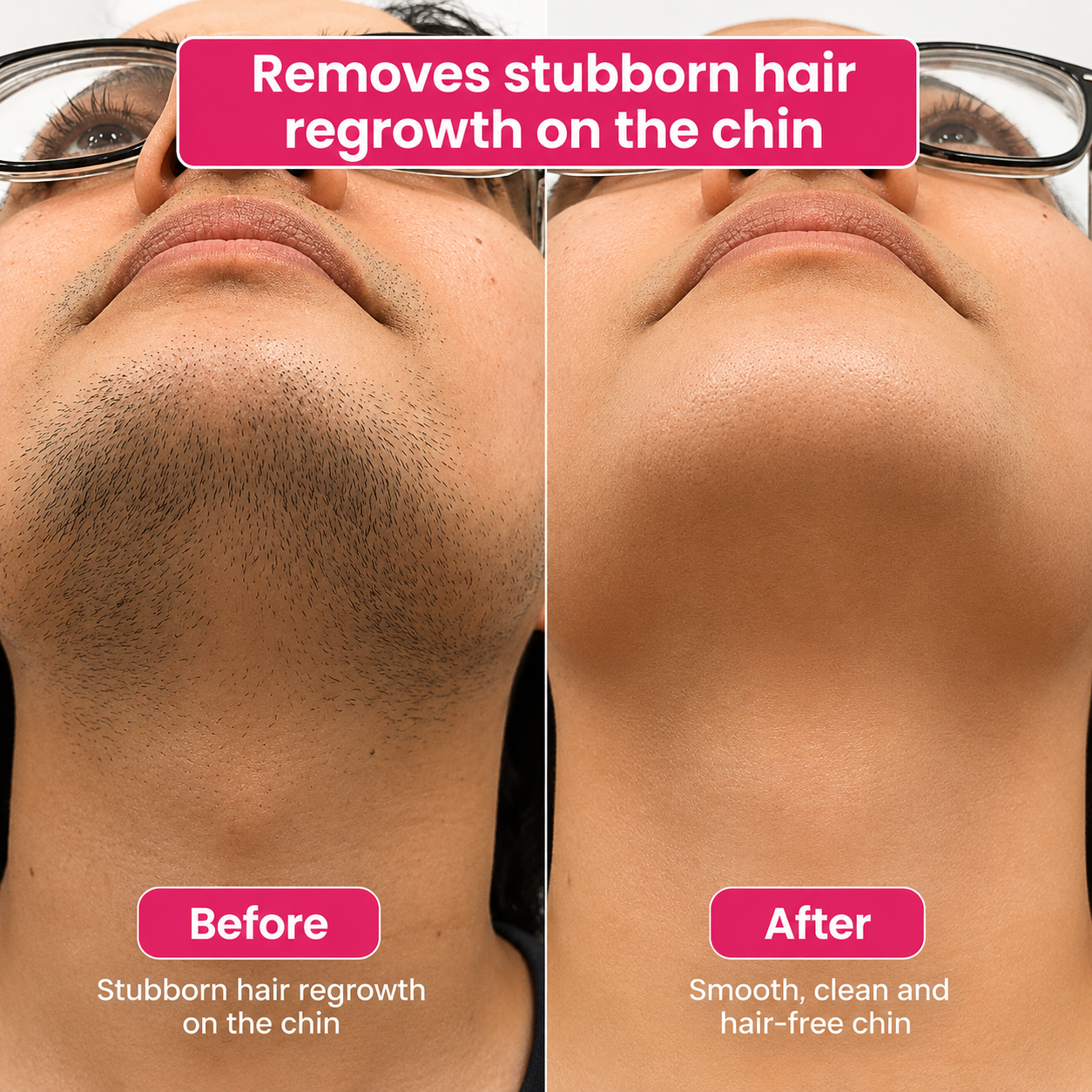🔥LAST DAY 60% OFF  PURENATUCARE Hair Reduction Oil 60 ml – Permanent Hair Removal Oil