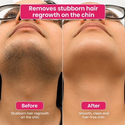 🔥LAST DAY 60% OFF  PURENATUCARE Hair Reduction Oil 60 ml – Permanent Hair Removal Oil